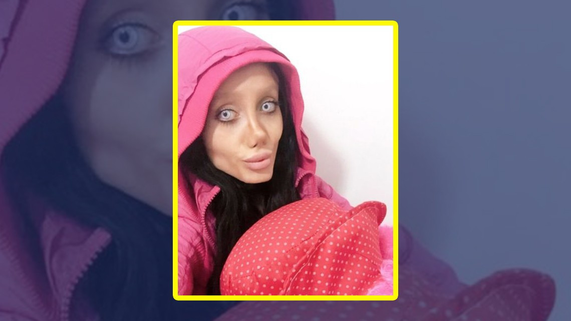 Mujer quería parecerse a Angelina Jolie pero ¡queda irreconocible!