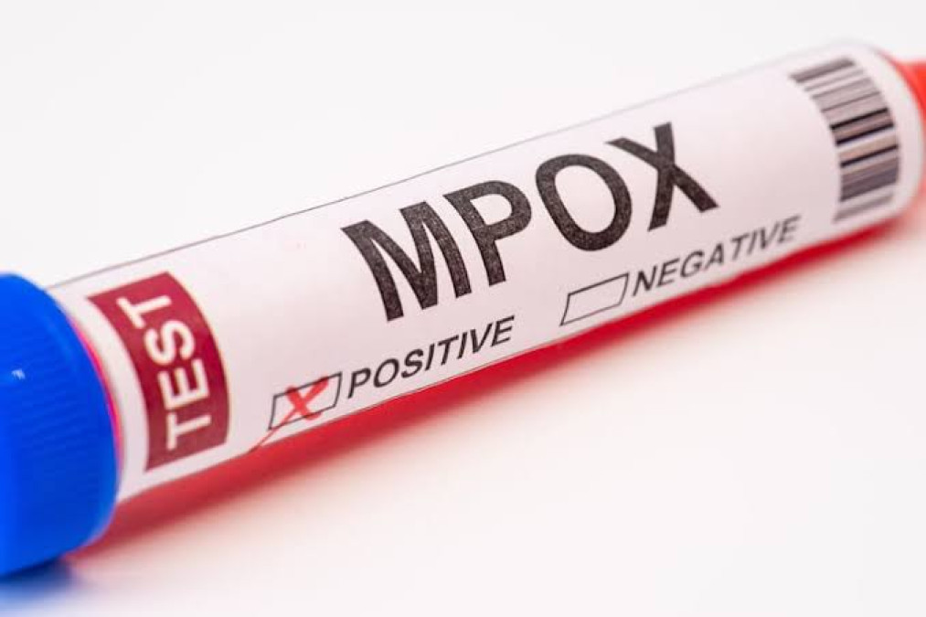 Detectan primer caso de la nueva variante de mpox en Francia