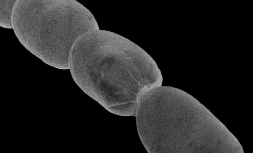 Se descubre bacteria gigante 