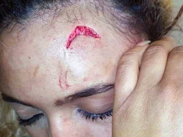 Modelo denuncia a primera dama de Zimbabue