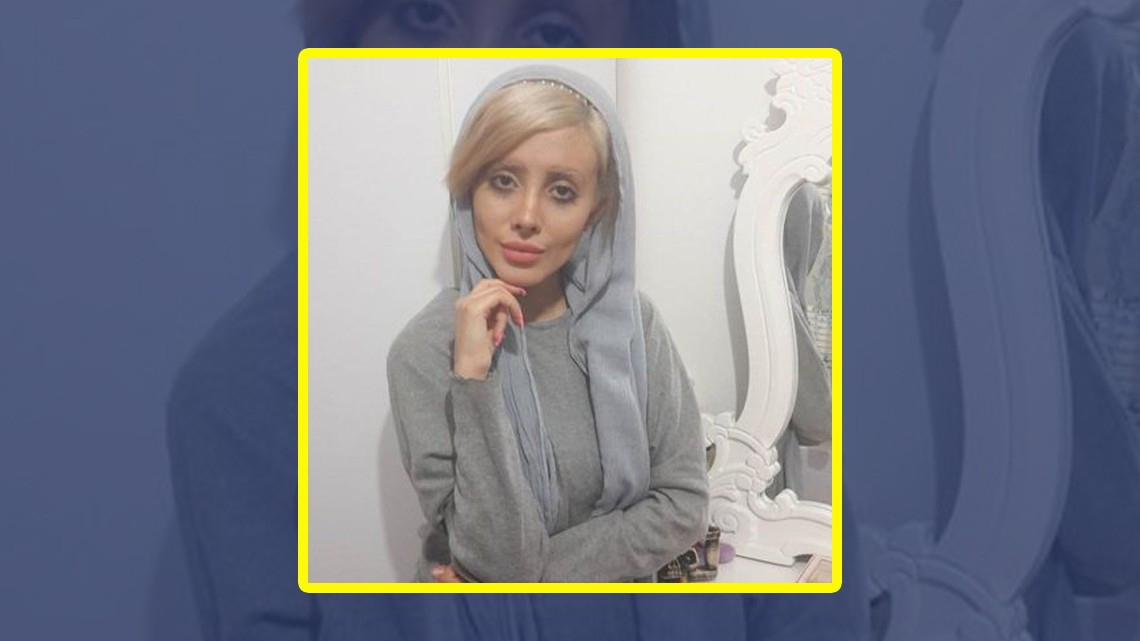 Mujer quería parecerse a Angelina Jolie pero ¡queda irreconocible!