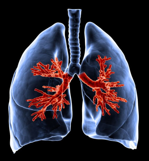 Buscan concientizar sobre ‘rara’ enfermedad que afecta la función pulmonar