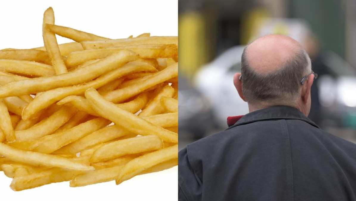 Papas fritas de McDonald´s podrían curar la calvicie