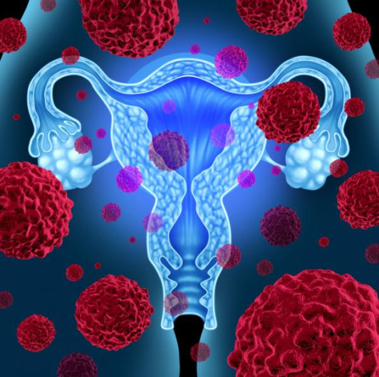 Cáncer de matriz al alza en el 2018