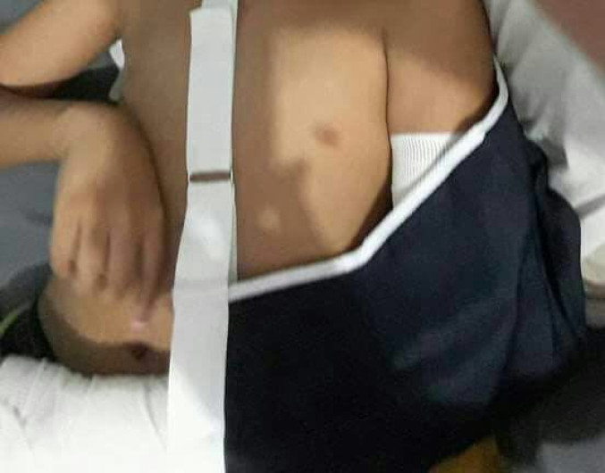 Compañeros de clase le fracturan brazo a alumno de escuela en Madero 