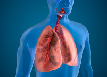 Tras fuerte tuberculosis, por fin regresarán a su hogar