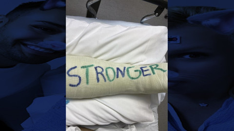 ¡Se fracturó! Britney Spears tuvo un accidente mientras bailaba