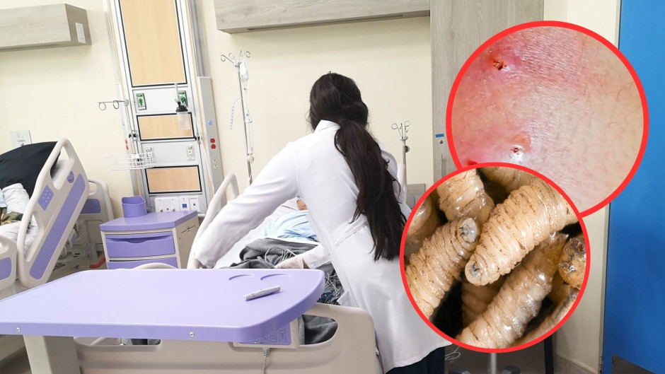 Honduras registra el primer caso de gusano barrenador en humanos