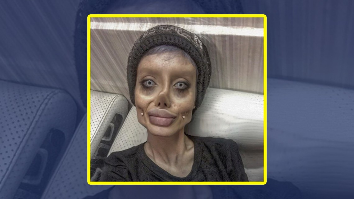 Mujer quería parecerse a Angelina Jolie pero ¡queda irreconocible!