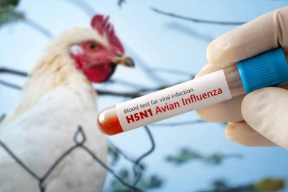 Muere la primera paciente reportada con gripe aviar H5N1 en México