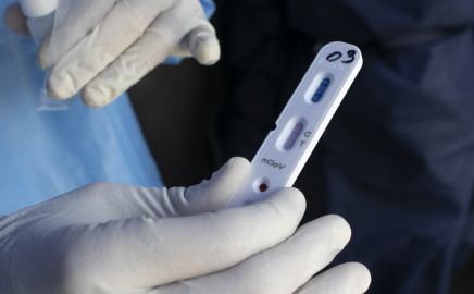FDA autoriza pruebas rápidas  de COVID-19; Se realizan en casa y arrojan resultados en 30 minutos  