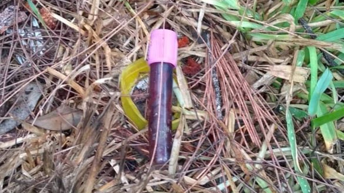 Encuentran muestras de sangre en laguna del Carpintero