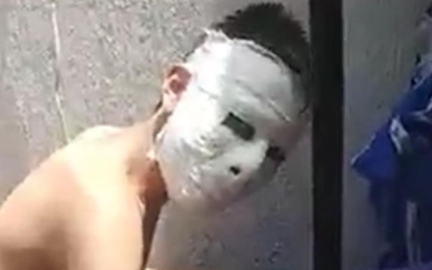 Joven hace máscara de yeso y se le queda pegada al rostro