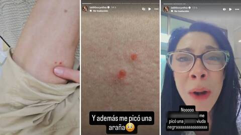 Hospitalizan de emergencia a Cinthya Klitbo tras mordida de araña Viuda Negra