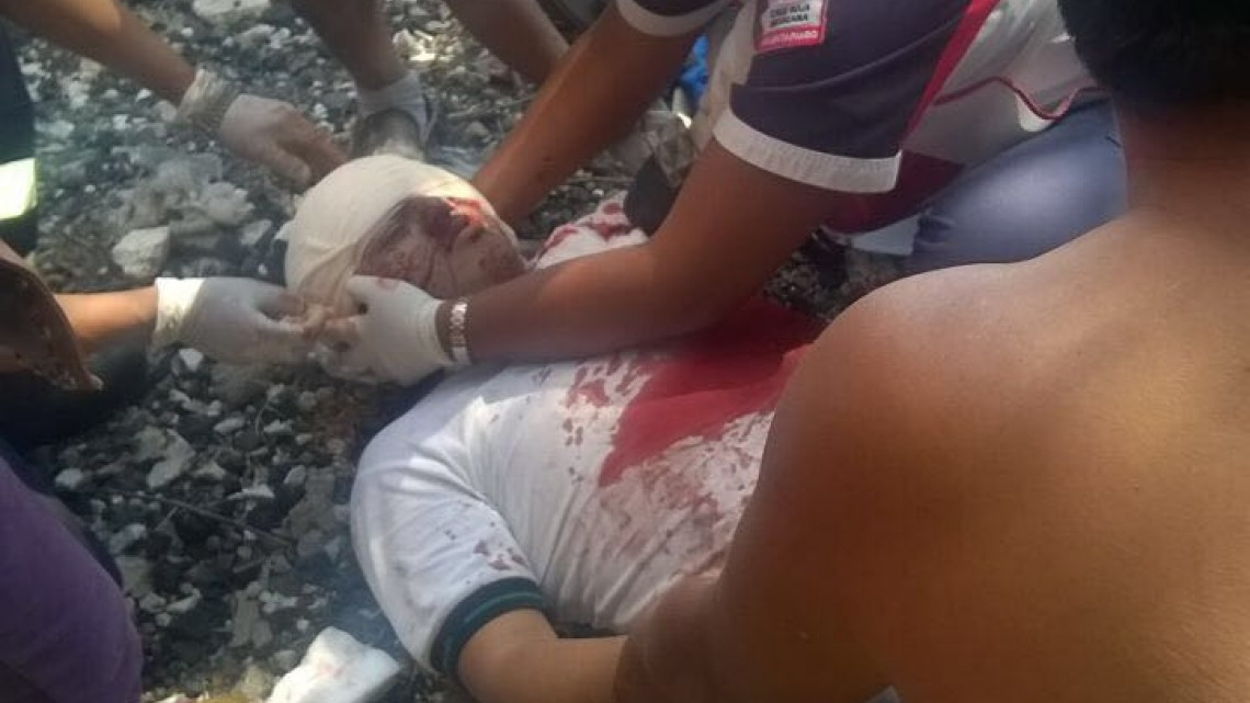 Tren le mutila brazo izquierdo a estudiante de Conalep
