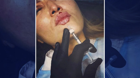 ¿Te atreverías a hacértelos? Llegan los “labios del diablo”, la nueva moda en redes