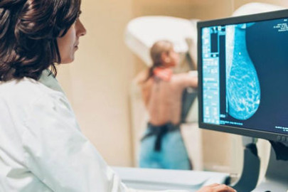 Google Health desarrolla sistema que identifica el cáncer de mama 