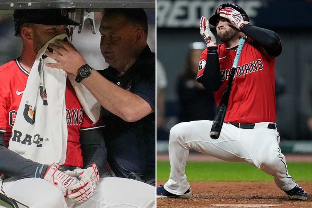 David Fry sufre fracturas faciales tras brutal pelotazo en la MLB