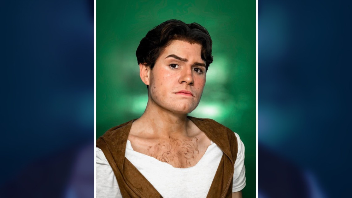 Shrek humano, ¡es real!