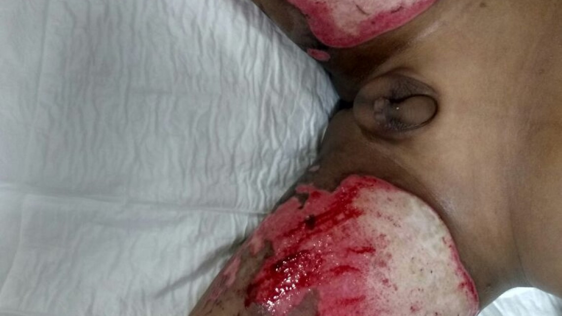 Exige justicia madre de pequeño quemado 