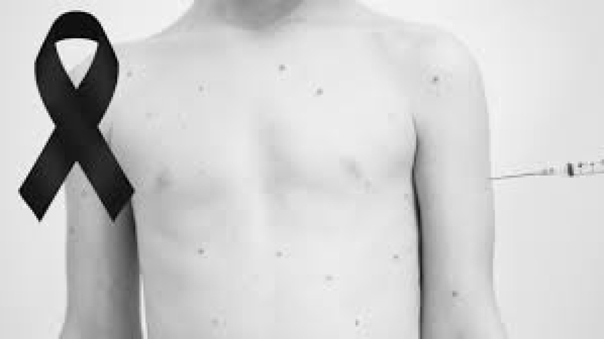 Mueren dos menores de edad por sarampión en Chihuahua