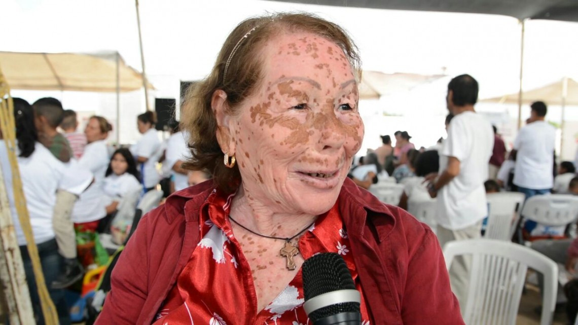 DIF Reynosa y "Unidos Por Reynosa" trabaja en conjunto