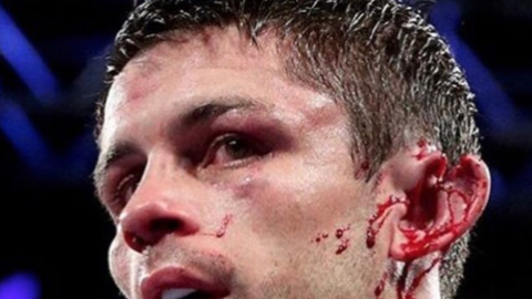 Boxeador mexicano casi deja sin oreja a rival