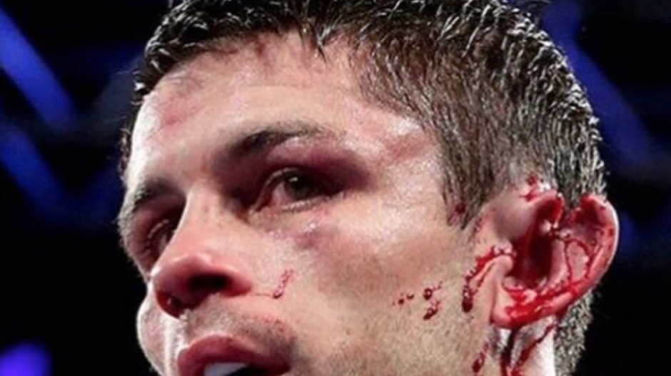 Boxeador mexicano casi deja sin oreja a rival