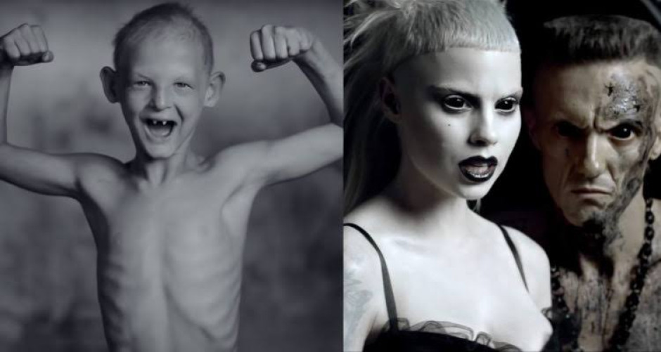 Hijo adoptivo de Die Antwoord los acusa de abuso sexual 