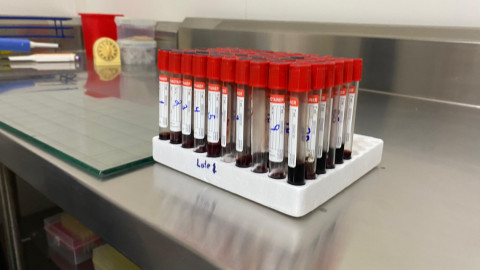 Realizan más de 8 mil pruebas de brucelosis en ganado