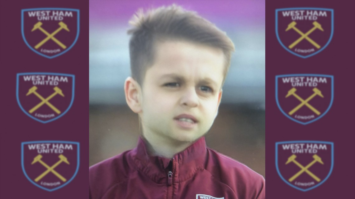 Presume West Ham foto de 'Chicharito' con filtro de bebé