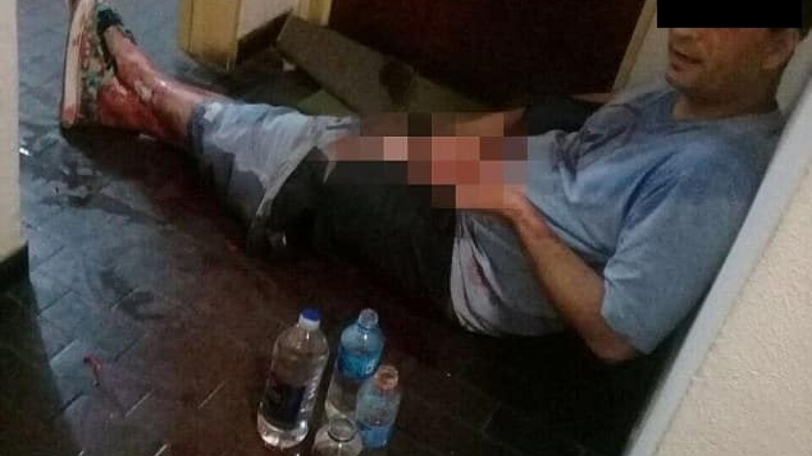 Mujer corta pene y testículos a su amante