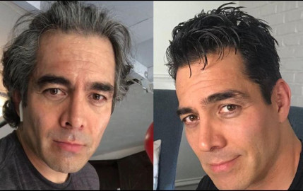 Sorprende Omar Chaparro con nuevo look