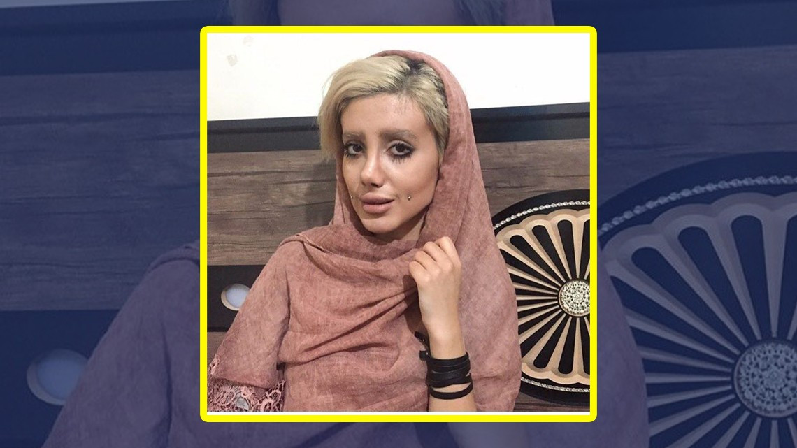 Mujer quería parecerse a Angelina Jolie pero ¡queda irreconocible!