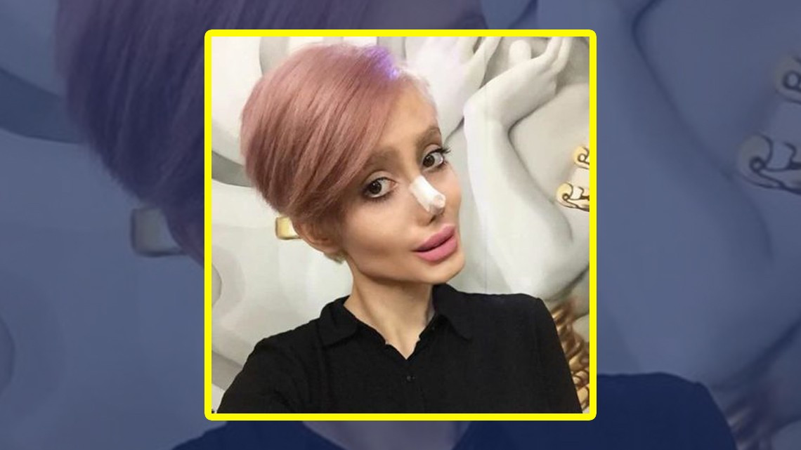 Mujer quería parecerse a Angelina Jolie pero ¡queda irreconocible!