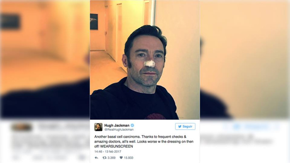 Hugh Jackman publica su nueva cirugía por cáncer de piel