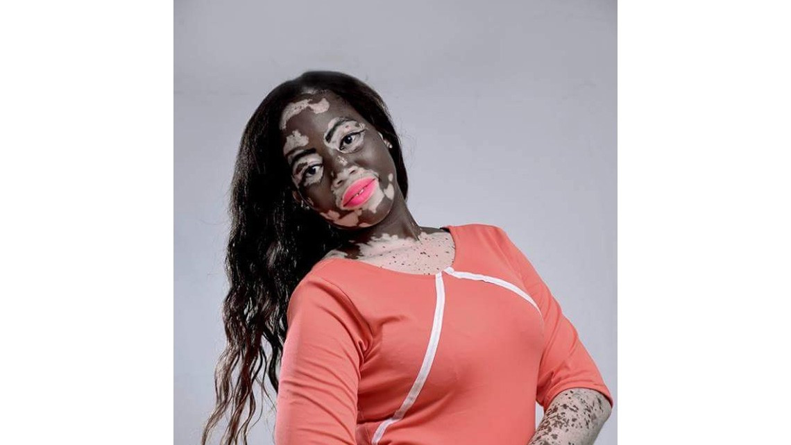 Honya Enam, una modelo que supero los estereotipos