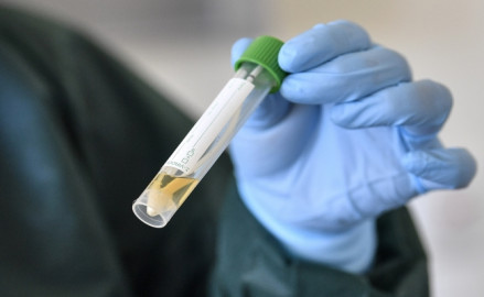 Confirman 348 casos nuevos de coronavirus y 15 fallecimientos en Tamaulipas