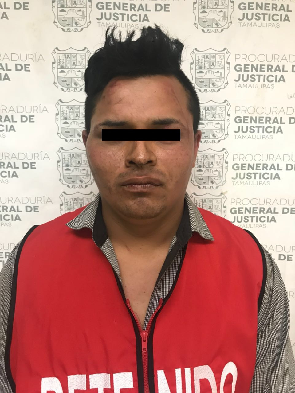 Detienen a ladrón que asolaba a la UAT Tampico