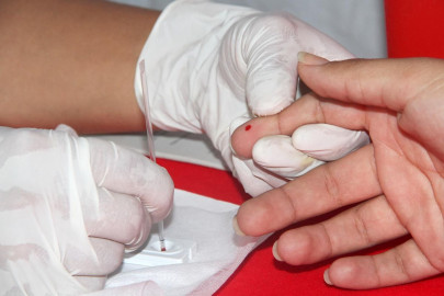 Gobierno de Duarte compró pruebas falsas de VIH