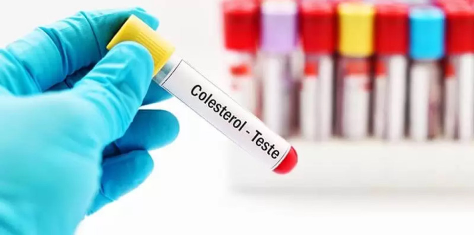 Colesterol alto: 4 de cada 10 mexicanos lo padecen; el riesgo es infarto cerebral