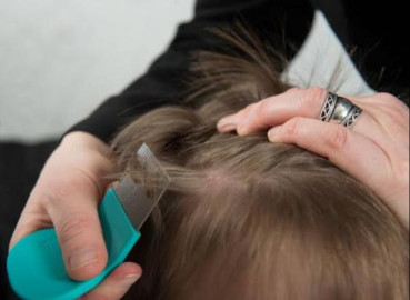 Reportan brote de pediculosis en escuela de Madero